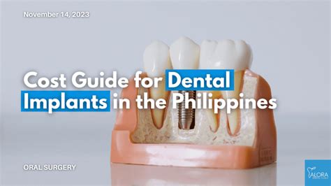 dental implant price philippines